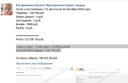 2015-09-03 14-41-20 Отчеты.   Кагарманова Анелия ! Врожденный порок сердца. - Google Chrome.png